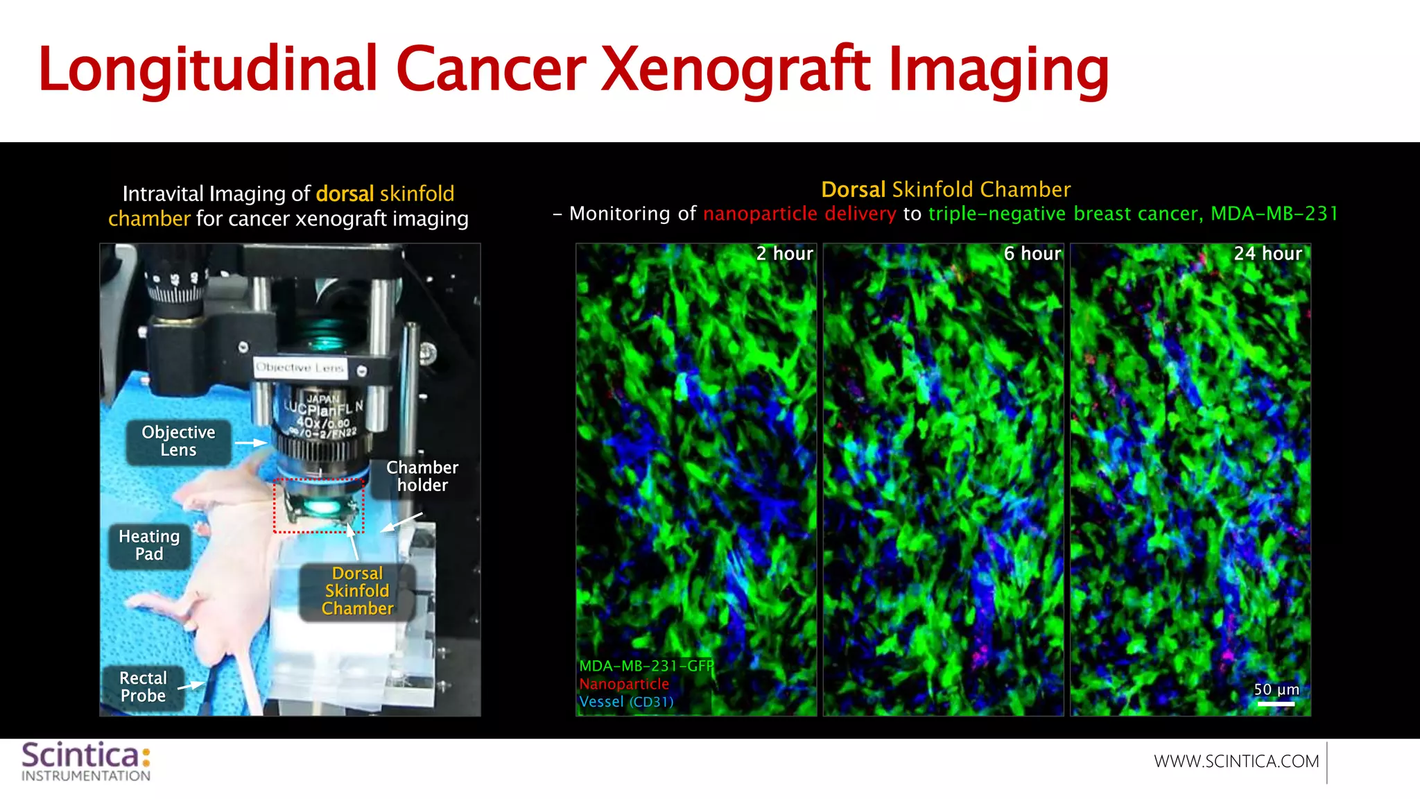 WWW.SCINTICA.COM
Longitudinal Cancer Xenograft Imaging
Intravital Imaging of dorsal skinfold
chamber for cancer xenograft imaging
Dorsal Skinfold Chamber
- Monitoring of nanoparticle delivery to triple-negative breast cancer, MDA-MB-231
50 μm
2 hour 6 hour 24 hour
MDA-MB-231-GFP
Nanoparticle
Vessel (CD31)
Objective
Lens
Heating
Pad
Rectal
Probe
Chamber
holder
Dorsal
Skinfold
Chamber
 