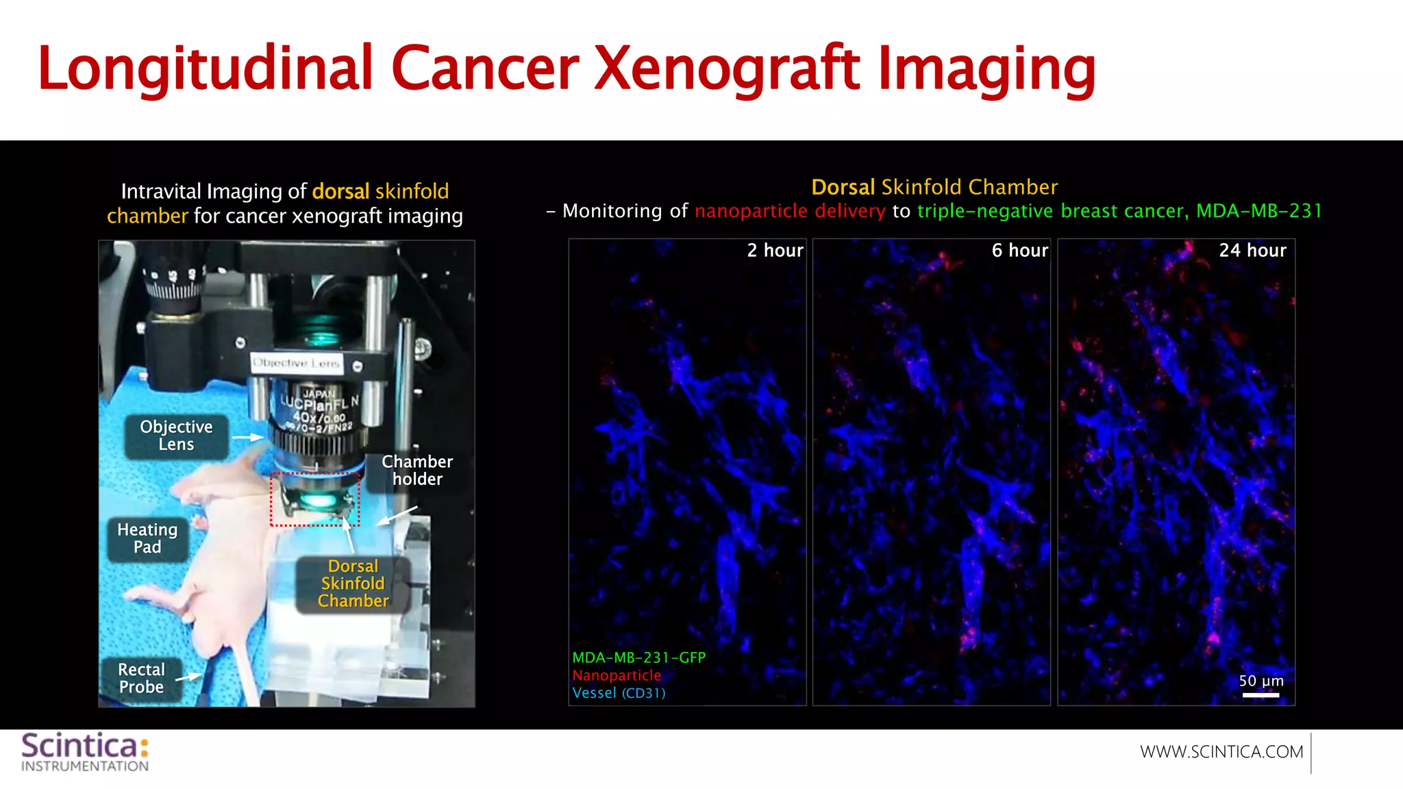 WWW.SCINTICA.COM
Longitudinal Cancer Xenograft Imaging
Intravital Imaging of dorsal skinfold
chamber for cancer xenograft imaging
Dorsal Skinfold Chamber
- Monitoring of nanoparticle delivery to triple-negative breast cancer, MDA-MB-231
50 μm
2 hour 6 hour 24 hour
MDA-MB-231-GFP
Nanoparticle
Vessel (CD31)
Objective
Lens
Heating
Pad
Rectal
Probe
Chamber
holder
Dorsal
Skinfold
Chamber
 