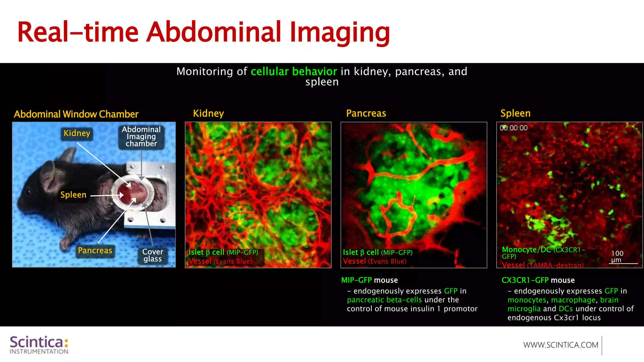 WWW.SCINTICA.COM
Real-time Abdominal Imaging
Abdominal Window Chamber
Monitoring of cellular behavior in kidney, pancreas, and
spleen
Cover
glass
Kidney
Spleen
Abdominal
Imaging
chamber
Pancreas Islet  cell (MIP-GFP)
Vessel (Evans Blue)
MIP-GFP mouse
- endogenously expresses GFP in
pancreatic beta-cells under the
control of mouse insulin 1 promotor
Monocyte/DC (CX3CR1-
GFP)
Vessel (TAMRA-dextran)
CX3CR1-GFP mouse
- endogenously expresses GFP in
monocytes, macrophage, brain
microglia and DCs under control of
endogenous Cx3cr1 locus
Pancreas Spleen
100
μm
Kidney
Islet  cell (MIP-GFP)
Vessel (Evans Blue)
 