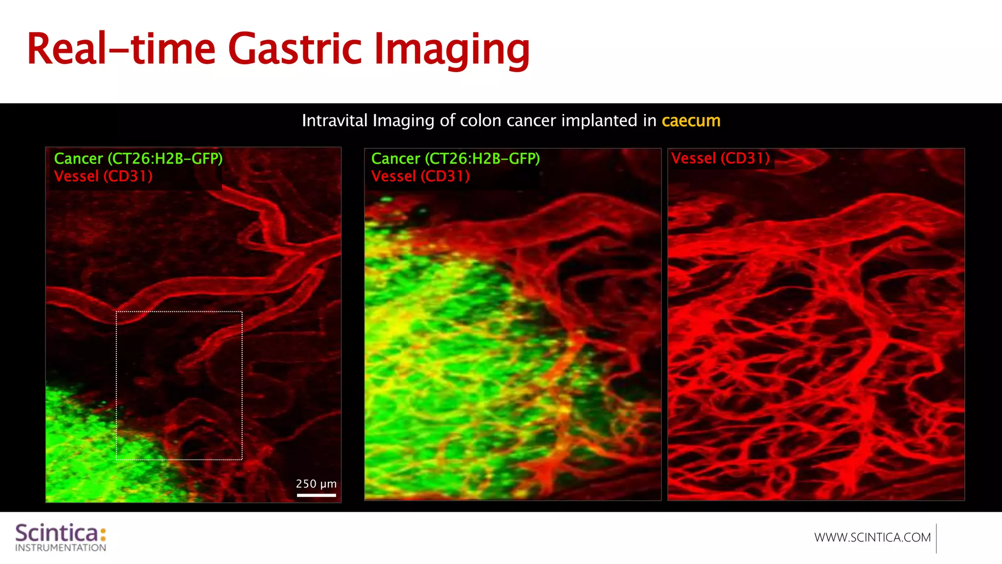 WWW.SCINTICA.COM
Real-time Gastric Imaging
Intravital Imaging of colon cancer implanted in caecum
250 µm
Cancer (CT26:H2B-GFP)
Vessel (CD31)
Cancer (CT26:H2B-GFP)
Vessel (CD31)
Vessel (CD31)
 