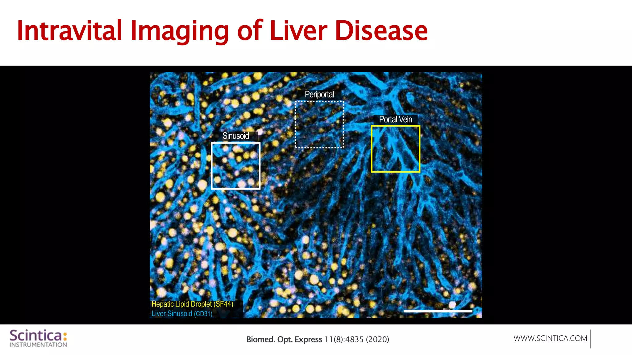WWW.SCINTICA.COM
Intravital Imaging of Liver Disease
Biomed. Opt. Express 11(8):4835 (2020)
Hepatic Lipid Droplet (SF44)
Liver Sinusoid (CD31)
Portal Vein
Periportal
Sinusoid
 
