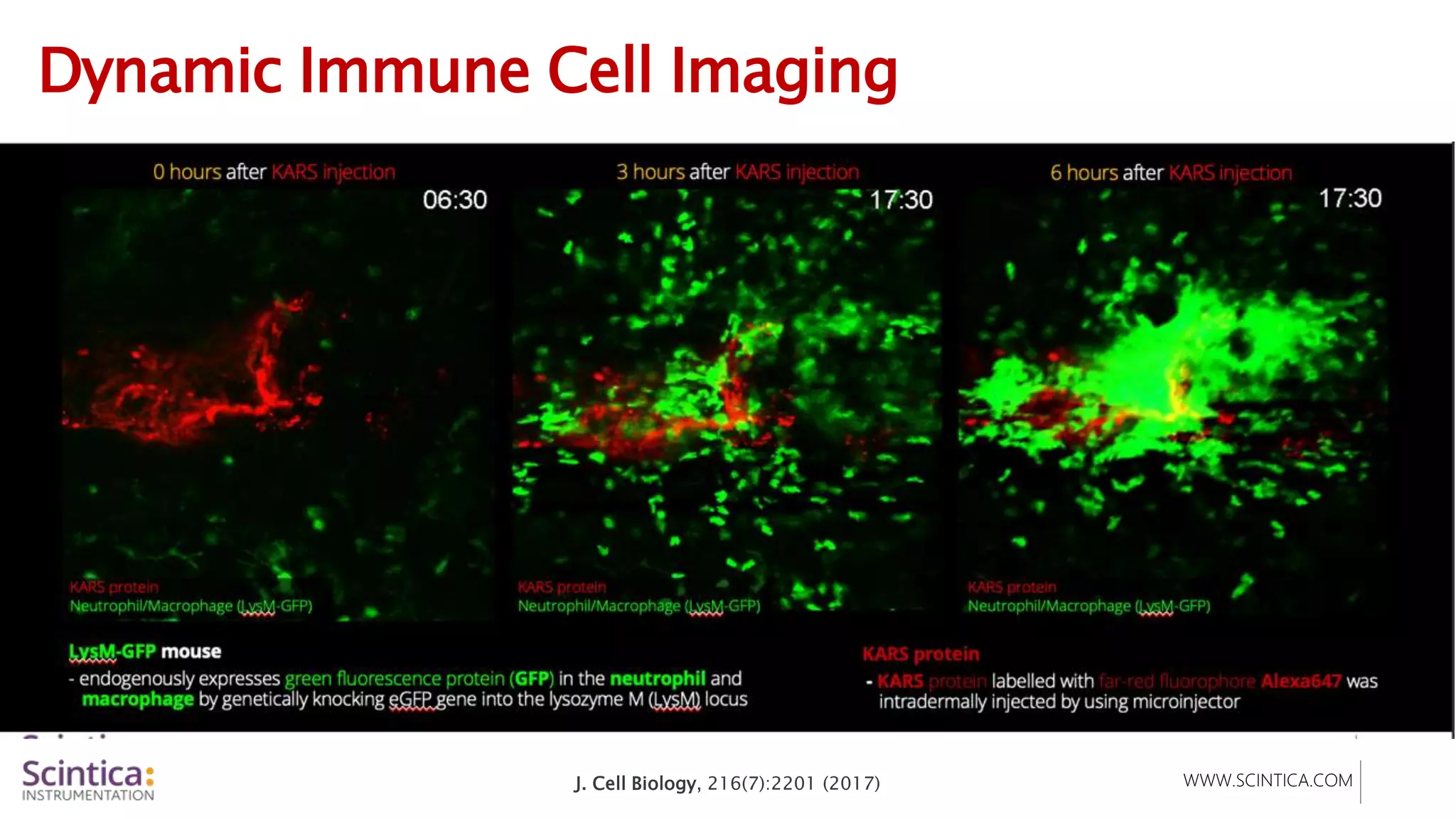 WWW.SCINTICA.COM
Dynamic Immune Cell Imaging
KARS protein
- KARS protein labelled with far-red fluorophore
Alexa647 was intradermally injected by using
microinjector
3 hurs after KARS injection 6 hours after KARS injection
J. Cell Biology, 216(7):2201 (2017)
KARS protein
Neutrophil/Macrophage (LysM-GFP)
LysM-GFP mouse
- endogenously expresses green fluorescence protein (GFP) in the neutrophil
and macrophage by genetically knocking eGFP gene into the lysozyme M
(LysM) locus
 