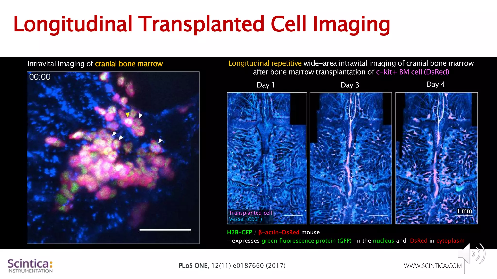 WWW.SCINTICA.COM
Longitudinal Transplanted Cell Imaging
H2B-GFP / β-actin-DsRed mouse
- expresses green fluorescence protein (GFP) in the nucleus and DsRed in cytoplasm
Longitudinal repetitive wide-area intravital imaging of cranial bone marrow
after bone marrow transplantation of c-kit+ BM cell (DsRed)
Day 1
Intravital Imaging of cranial bone marrow
Day 3 Day 4
1 mm
Transplanted cell
Vessel (CD31)
PLoS ONE, 12(11):e0187660 (2017)
 