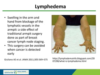 http://lymphademainfo.blogspot.com/20
07/08/what-is-lymphadema.html
• Swelling in the arm and
hand from blockage of the
lymphatic vessels in the
armpit: a side effect of
traditional armpit surgery
done as part of breast
cancer lymph node staging.
• This surgery can be avoided
when cancer is detected
early
Lymphedema
Giuliano AE et al. JAMA 2011;305:569–575
 