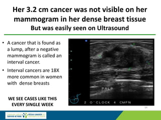 Her 3.2 cm cancer was not visible on her
mammogram in her dense breast tissue
But was easily seen on Ultrasound
64
• A cancer that is found as
a lump, after a negative
mammogram is called an
interval cancer.
• Interval cancers are 18X
more common in women
with dense breasts
WE SEE CASES LIKE THIS
EVERY SINGLE WEEK
 
