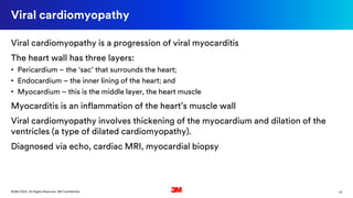 13©3M 2020. All Rights Reserved. 3M Confidential.
Viral cardiomyopathy
Viral cardiomyopathy is a progression of viral myocarditis
The heart wall has three layers:
• Pericardium – the ‘sac’ that surrounds the heart;
• Endocardium – the inner lining of the heart; and
• Myocardium – this is the middle layer, the heart muscle
Myocarditis is an inflammation of the heart’s muscle wall
Viral cardiomyopathy involves thickening of the myocardium and dilation of the
ventricles (a type of dilated cardiomyopathy).
Diagnosed via echo, cardiac MRI, myocardial biopsy
 