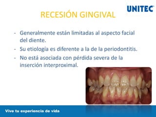 RECESIÓN GINGIVAL
- Generalmente están limitadas al aspecto facial
del diente.
- Su etiología es diferente a la de la periodontitis.
- No está asociada con pérdida severa de la
inserción interproximal.
 