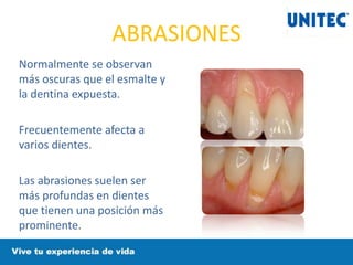 ABRASIONES
Normalmente se observan
más oscuras que el esmalte y
la dentina expuesta.
Frecuentemente afecta a
varios dientes.
Las abrasiones suelen ser
más profundas en dientes
que tienen una posición más
prominente.
 
