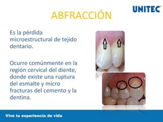 ABFRACCIÓN
Es la pérdida
microestructural de tejido
dentario.
Ocurre comúnmente en la
región cervical del diente,
donde existe una ruptura
del esmalte y micro
fracturas del cemento y la
dentina.
 