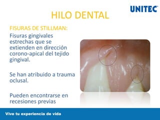 HILO DENTAL
FISURAS DE STILLMAN:
Fisuras gingivales
estrechas que se
extienden en dirección
corono-apical del tejido
gingival.
Se han atribuido a trauma
oclusal.
Pueden encontrarse en
recesiones previas
 