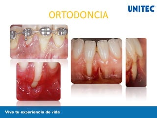 ORTODONCIA
 