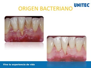 ORIGEN BACTERIANO
 