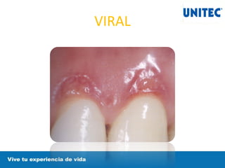 VIRAL
 