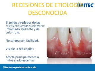 RECESIONES DE ETIOLOGÍA
DESCONOCIDA
El tejido alrededor de las
raíces expuestas suele verse
inflamado, brillante y de
color rojo.
No sangra con facilidad.
Visible la red capilar.
Afecta principalmente a
niños y adolescentes.
 