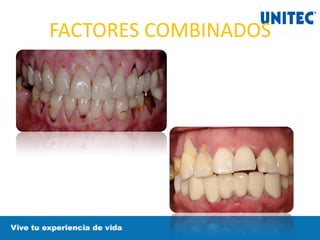 FACTORES COMBINADOS
 