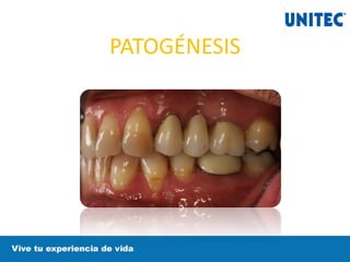 PATOGÉNESIS
 