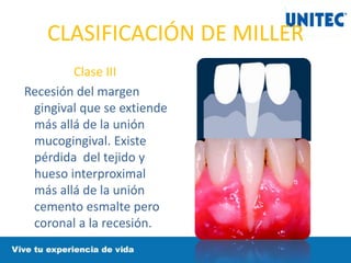 CLASIFICACIÓN DE MILLER
Clase III
Recesión del margen
gingival que se extiende
más allá de la unión
mucogingival. Existe
pérdida del tejido y
hueso interproximal
más allá de la unión
cemento esmalte pero
coronal a la recesión.
 