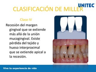CLASIFICACIÓN DE MILLER
Clase IV
Recesión del margen
gingival que se extiende
más allá de la unión
mucogingival. Existe
pérdida del tejido y
hueso interproximal
que se extiende apical a
la recesión.
 