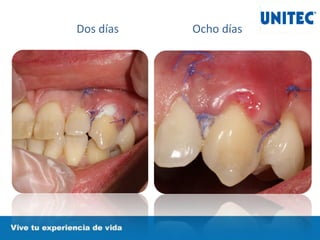 Dos días Ocho días
 