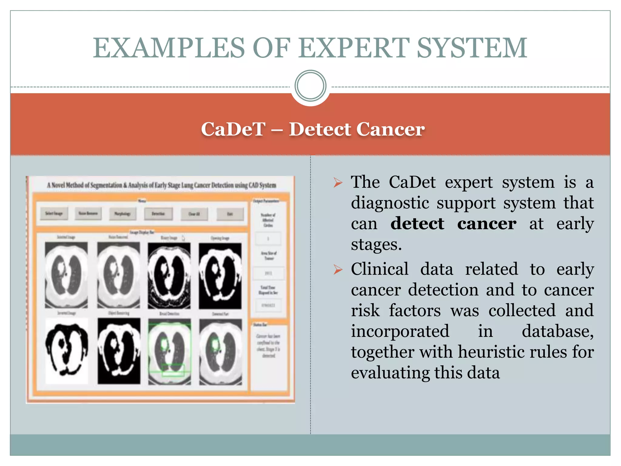 CaDeT – Detect Cancer
EXAMPLES OF EXPERT SYSTEM
 The CaDet expert system is a
diagnostic support system that
can detect cancer at early
stages.
 Clinical data related to early
cancer detection and to cancer
risk factors was collected and
incorporated in database,
together with heuristic rules for
evaluating this data
 