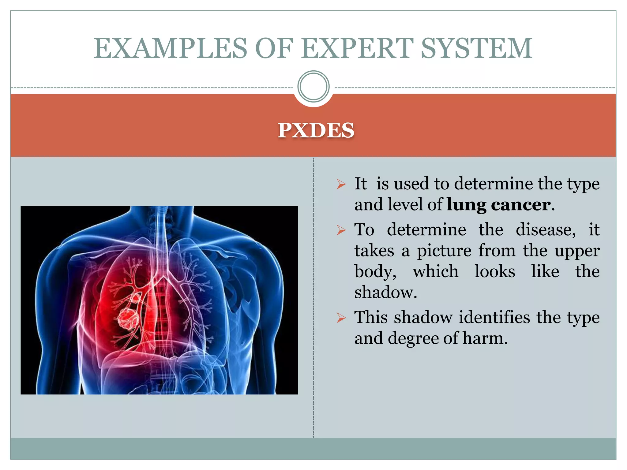 PXDES
EXAMPLES OF EXPERT SYSTEM
 It is used to determine the type
and level of lung cancer.
 To determine the disease, it
takes a picture from the upper
body, which looks like the
shadow.
 This shadow identifies the type
and degree of harm.
 