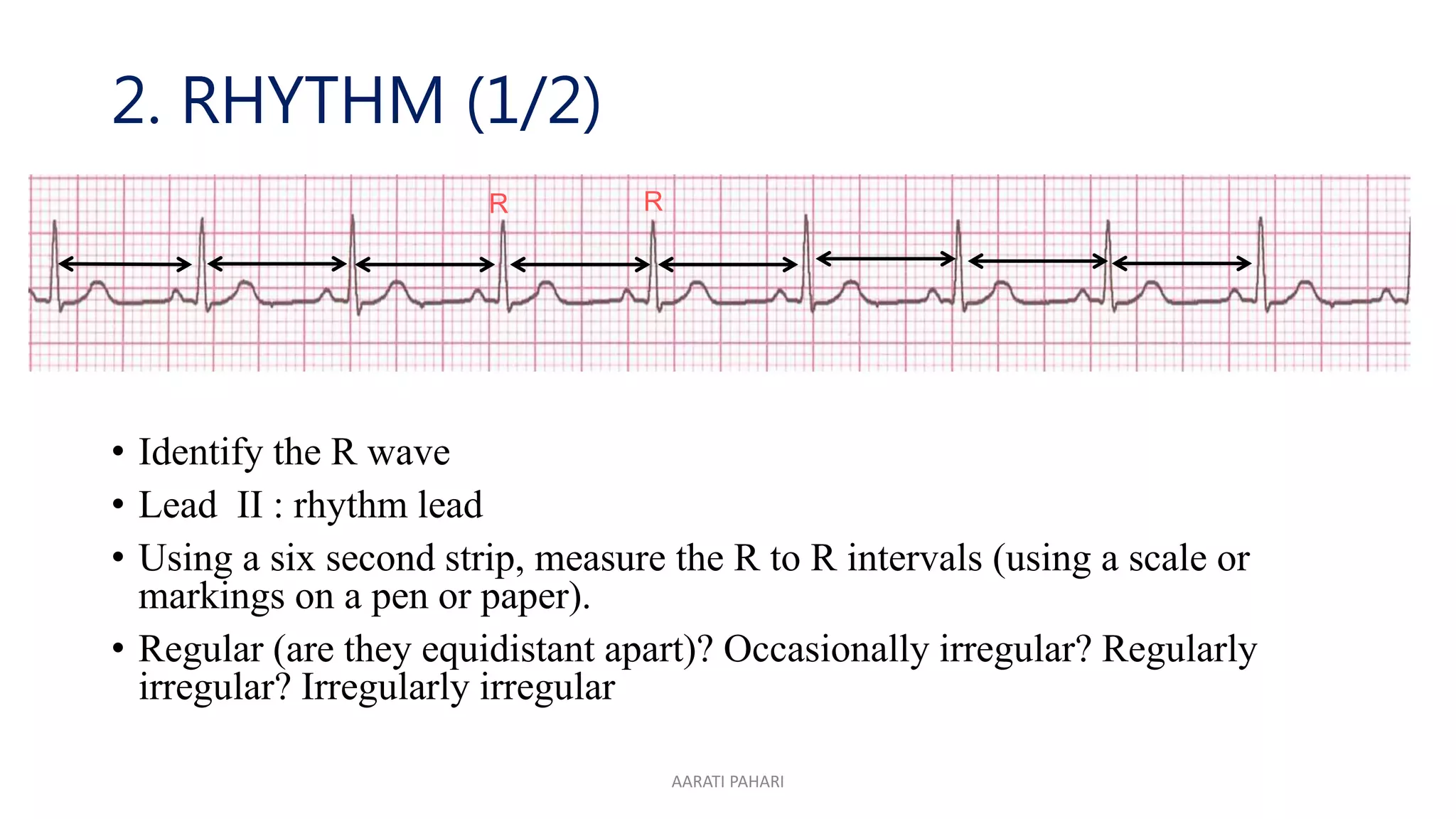 ECG AND ITS INTERPRETATION.pptx