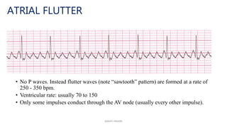 ECG AND ITS INTERPRETATION.pptx