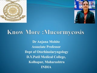 Dr Anjana Mohite
Associate Professor
Dept of Otorhinolaryngology
D.Y.Patil Medical College,
Kolhapur, Maharashtra
INDIA
 