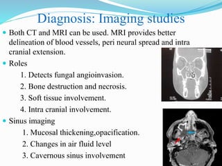 Diagnosis: Imaging studies
 Both CT and MRI can be used. MRI provides better
delineation of blood vessels, peri neural spread and intra
cranial extension.
 Roles
1. Detects fungal angioinvasion.
2. Bone destruction and necrosis.
3. Soft tissue involvement.
4. Intra cranial involvement.
 Sinus imaging
1. Mucosal thickening,opacification.
2. Changes in air fluid level
3. Cavernous sinus involvement
 