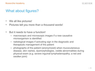 | 10
What about figures?
• We all like pictures!
• Pictures tell you more than a thousand words!
• But it needs to have a function!
– macroscopic and microscopic images if a new causative
microorganism is identified
– radiological images if activating sign in the diagnostic and
therapeutic management of the patient
– photographs of the patient (anonymized) when mucocutaneous
disease, skin rashes, dysmorphologies, visible abnormalities during
physical exam (e.g. severe inguinal lymphadenopathy; a red and
swollen joint)
 
