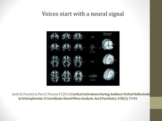 Voices start with a neural signal




Jardri R, Pouchet A, Pins D, Thomas P (2011) Cortical Activations During Auditory Verbal Hallucinations
     in Schizophrenia: A Coordinate-Based Meta-Analysis. Am J Psychiatry, 168(1), 73-81
 