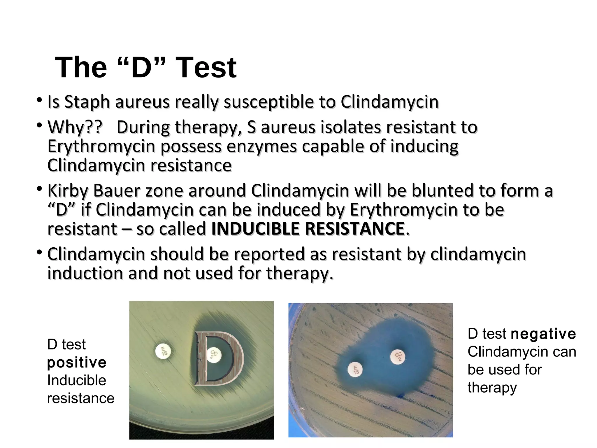The “D” Test
• Is Staph aureus really susceptible to ClindamycinIs Staph aureus really susceptible to Clindamycin
• Why?? During therapy, S aureus isolates resistant toWhy?? During therapy, S aureus isolates resistant to
Erythromycin possess enzymes capable of inducingErythromycin possess enzymes capable of inducing
Clindamycin resistanceClindamycin resistance
• Kirby Bauer zone around Clindamycin will be blunted to form aKirby Bauer zone around Clindamycin will be blunted to form a
“D” if Clindamycin can be induced by Erythromycin to be“D” if Clindamycin can be induced by Erythromycin to be
resistant – so calledresistant – so called INDUCIBLE RESISTANCEINDUCIBLE RESISTANCE..
• Clindamycin should be reported as resistant by clindamycinClindamycin should be reported as resistant by clindamycin
induction and not used for therapy.induction and not used for therapy.
D test
positive
Inducible
resistance
D test negative
Clindamycin can
be used for
therapy
 