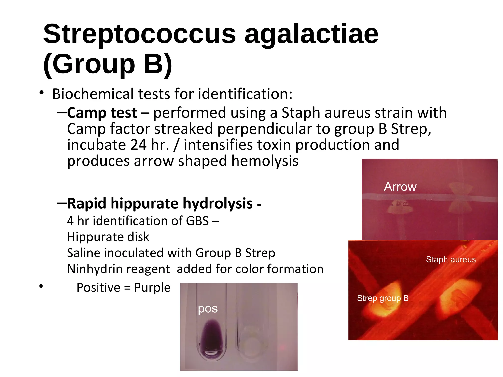 Streptococcus agalactiae
(Group B)
• Biochemical tests for identification:
–Camp test – performed using a Staph aureus strain with
Camp factor streaked perpendicular to group B Strep,
incubate 24 hr. / intensifies toxin production and
produces arrow shaped hemolysis
–Rapid hippurate hydrolysis -
4 hr identification of GBS –
Hippurate disk
Saline inoculated with Group B Strep
Ninhydrin reagent added for color formation
• Positive = Purple
pos
Arrow
Staph aureus
Strep group B
 