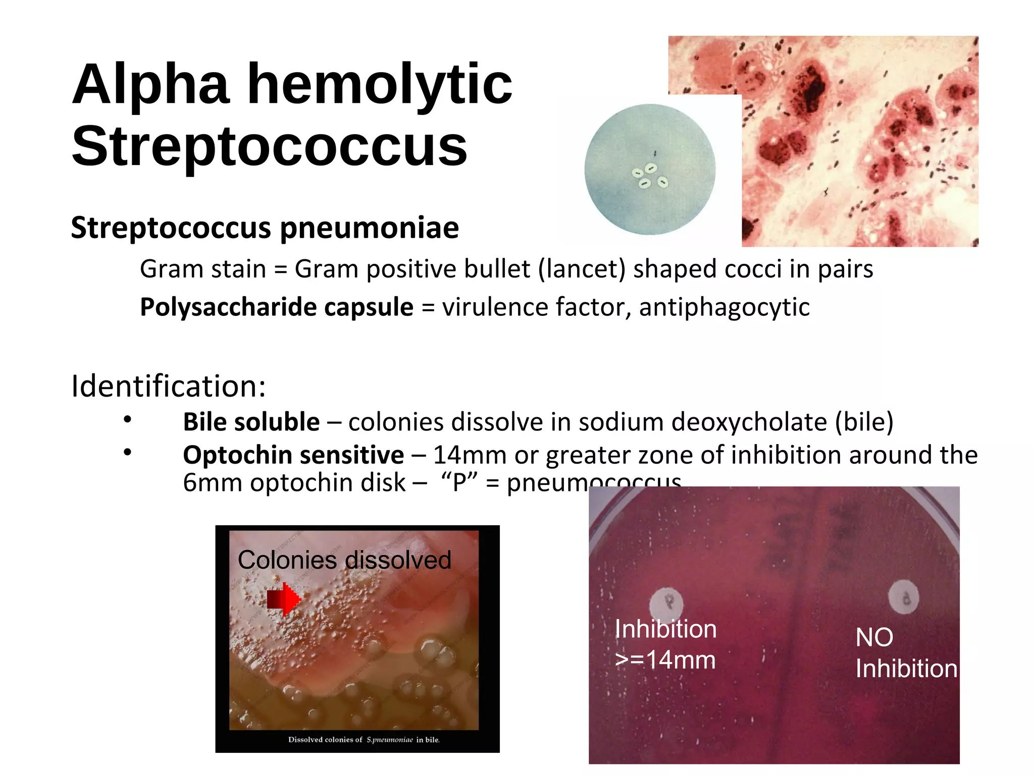 Alpha hemolytic
Streptococcus
Streptococcus pneumoniae
Gram stain = Gram positive bullet (lancet) shaped cocci in pairs
Polysaccharide capsule = virulence factor, antiphagocytic
Identification:
• Bile soluble – colonies dissolve in sodium deoxycholate (bile)
• Optochin sensitive – 14mm or greater zone of inhibition around the
6mm optochin disk – “P” = pneumococcus
Inhibition
>=14mm
NO
Inhibition
Colonies dissolved
 