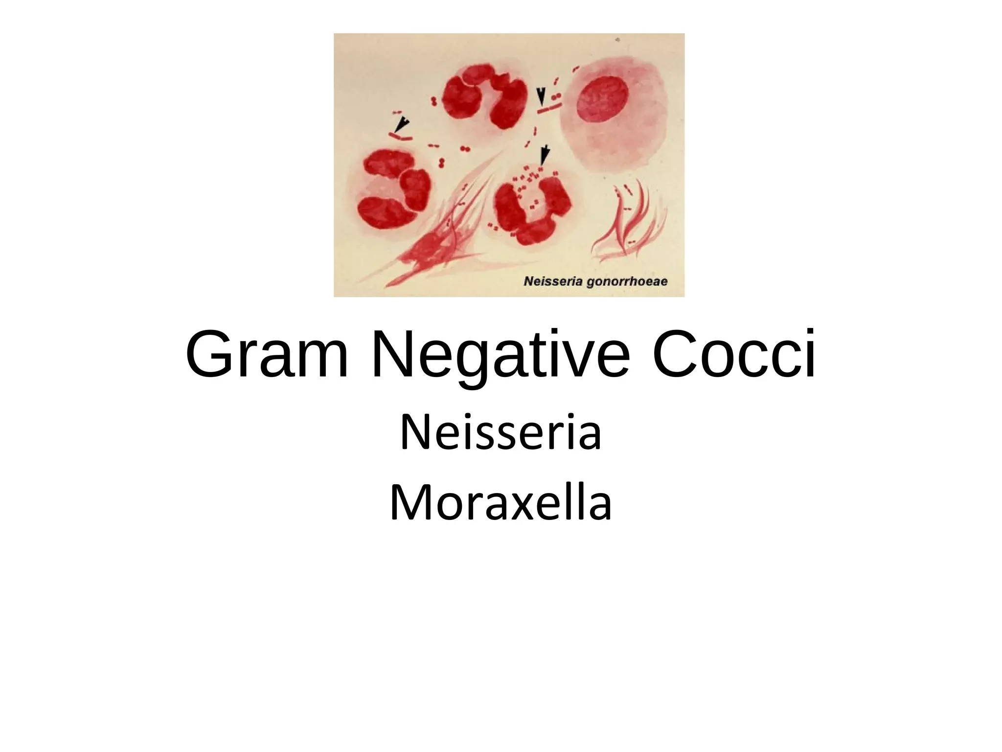 Gram Negative Cocci
Neisseria
Moraxella
 
