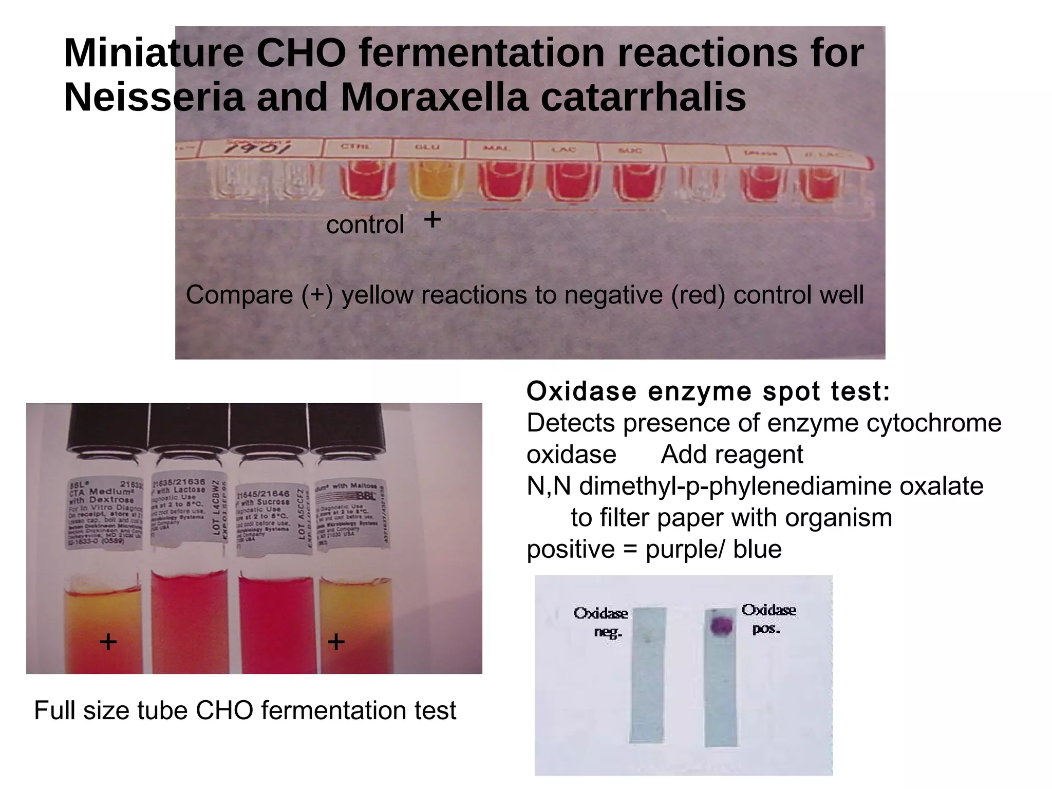 Miniature CHO fermentation reactions for
Neisseria and Moraxella catarrhalis
Compare (+) yellow reactions to negative (red) control well
+
+ +
Oxidase enzyme spot test:
Detects presence of enzyme cytochrome
oxidase Add reagent
N,N dimethyl-p-phylenediamine oxalate
to filter paper with organism
positive = purple/ blue
control
Full size tube CHO fermentation test
 