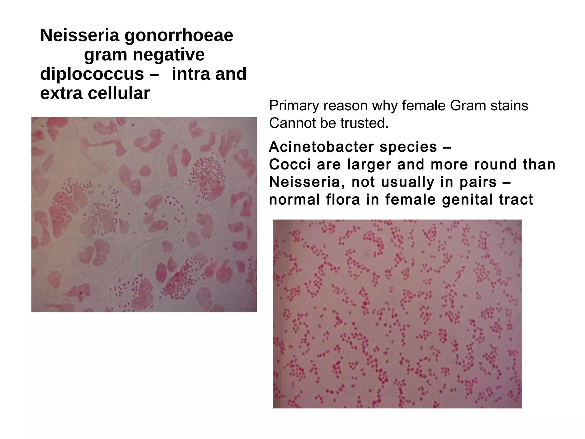 Neisseria gonorrhoeae
gram negative
diplococcus – intra and
extra cellular
Acinetobacter species –
Cocci are larger and more round than
Neisseria, not usually in pairs –
normal flora in female genital tract
Primary reason why female Gram stains
Cannot be trusted.
 