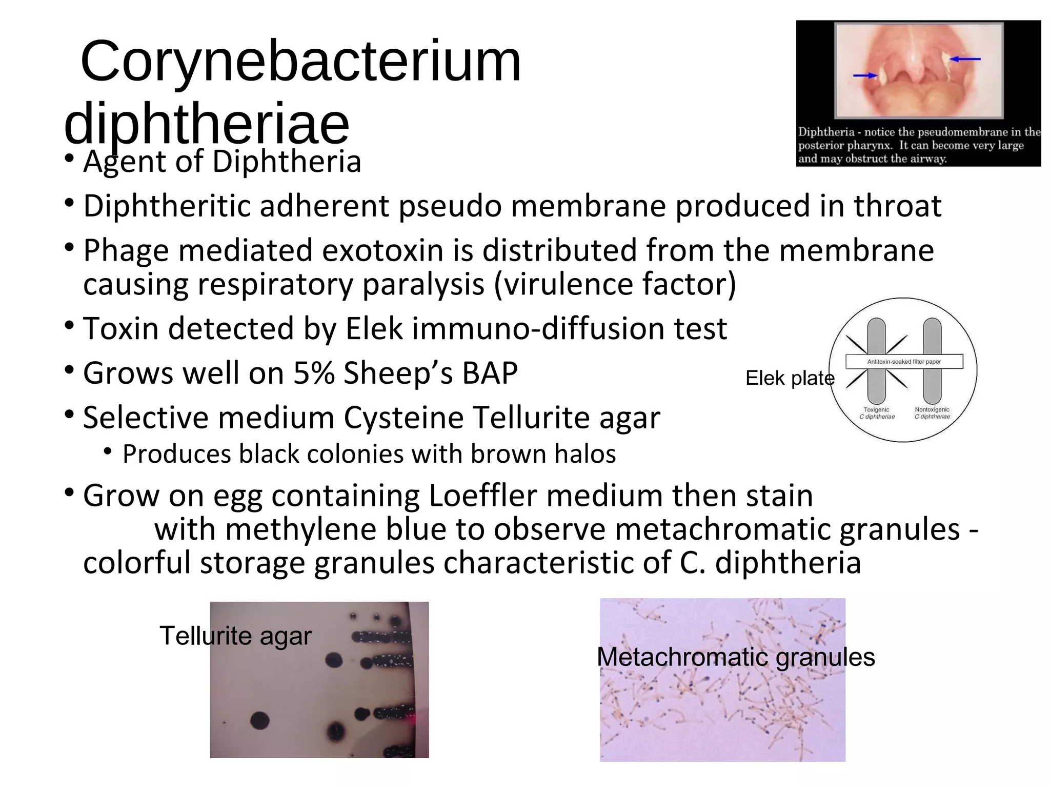 Corynebacterium
diphtheriae• Agent of Diphtheria
• Diphtheritic adherent pseudo membrane produced in throat
• Phage mediated exotoxin is distributed from the membrane
causing respiratory paralysis (virulence factor)
• Toxin detected by Elek immuno-diffusion test
• Grows well on 5% Sheep’s BAP
• Selective medium Cysteine Tellurite agar
• Produces black colonies with brown halos
• Grow on egg containing Loeffler medium then stain
with methylene blue to observe metachromatic granules -
colorful storage granules characteristic of C. diphtheria
Elek plate
Tellurite agar
Metachromatic granules
 