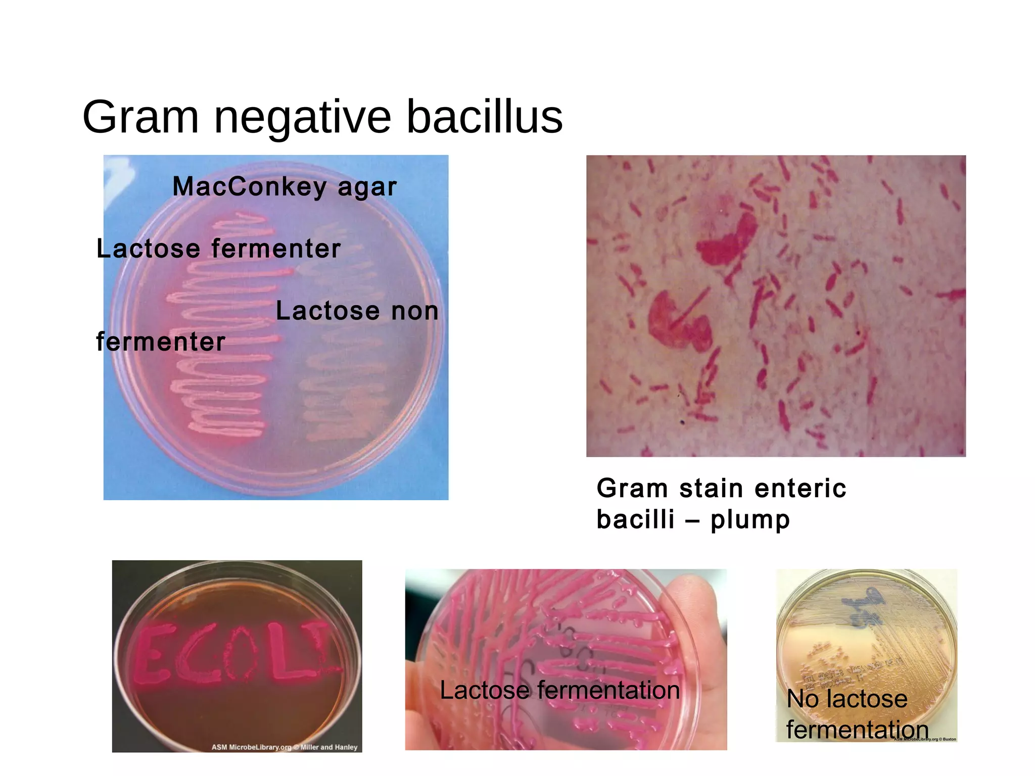 Gram negative bacillus
MacConkey agar
Lactose fermenter
Lactose non
fermenter
Gram stain enteric
bacilli – plump
No lactose
fermentation
Lactose fermentation
 