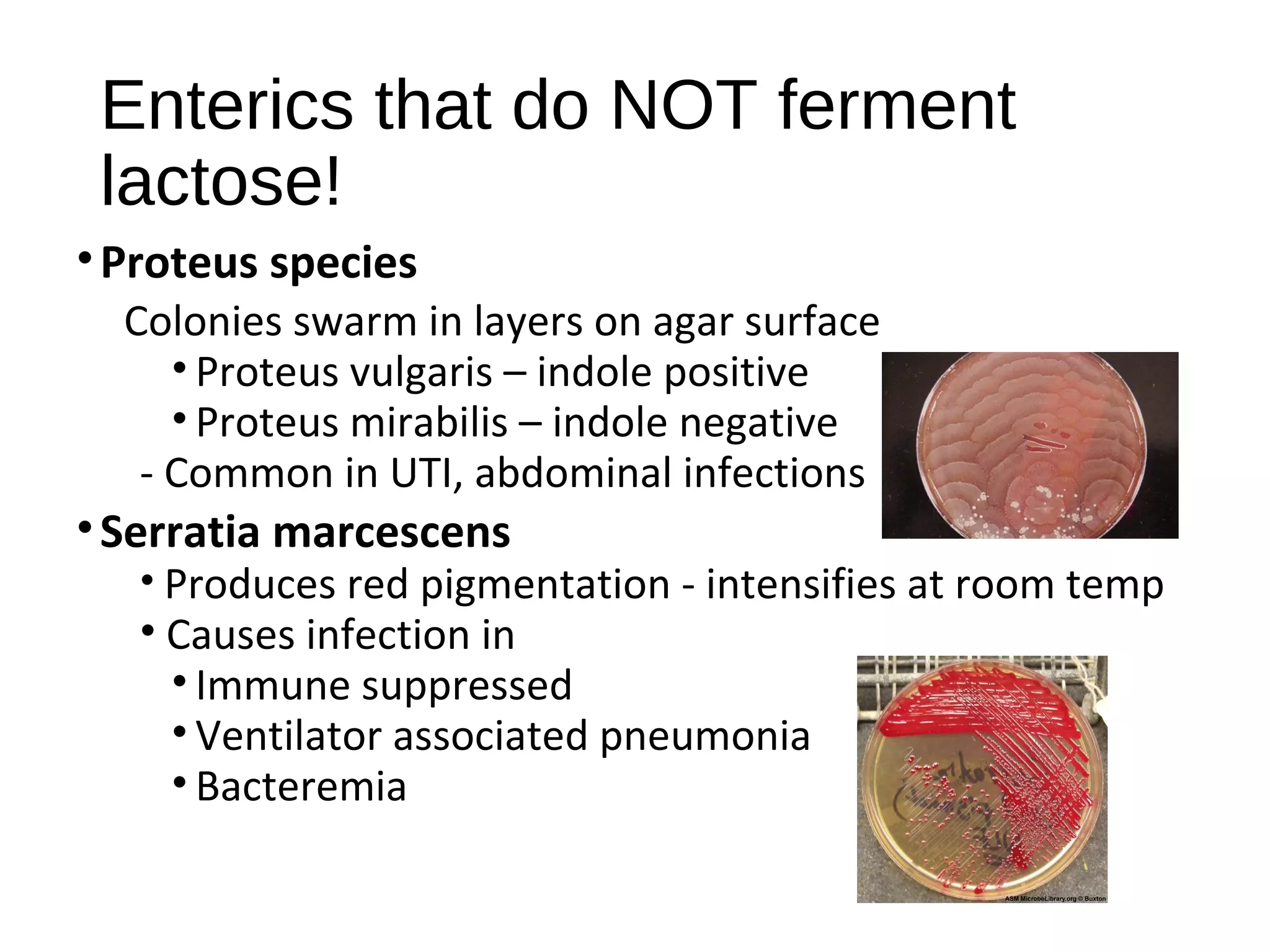 Enterics that do NOT ferment
lactose!
•Proteus species
Colonies swarm in layers on agar surface
• Proteus vulgaris – indole positive
• Proteus mirabilis – indole negative
- Common in UTI, abdominal infections
•Serratia marcescens
• Produces red pigmentation - intensifies at room temp
• Causes infection in
• Immune suppressed
• Ventilator associated pneumonia
• Bacteremia
 