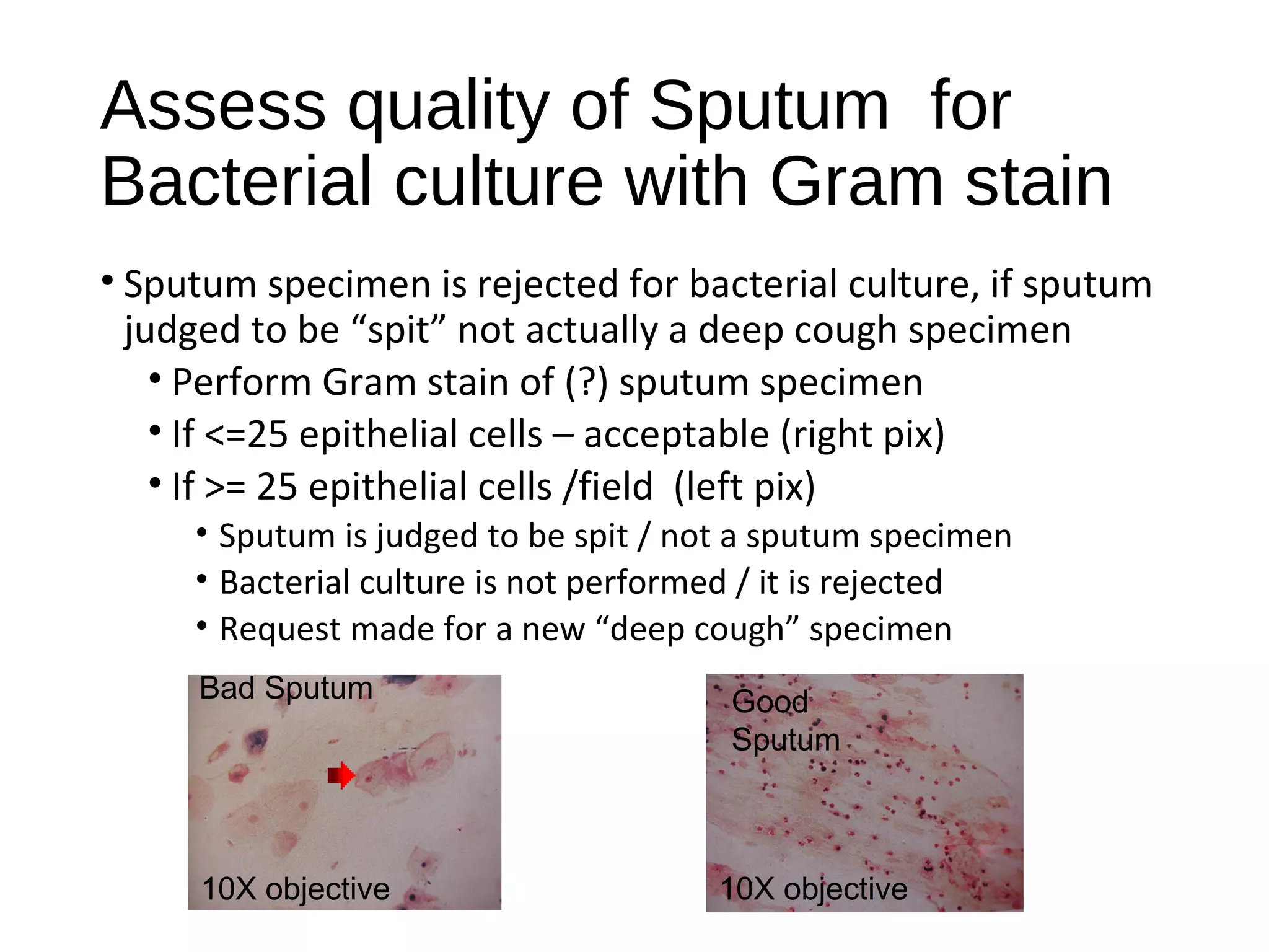 Assess quality of Sputum for
Bacterial culture with Gram stain
• Sputum specimen is rejected for bacterial culture, if sputum
judged to be “spit” not actually a deep cough specimen
• Perform Gram stain of (?) sputum specimen
• If <=25 epithelial cells – acceptable (right pix)
• If >= 25 epithelial cells /field (left pix)
• Sputum is judged to be spit / not a sputum specimen
• Bacterial culture is not performed / it is rejected
• Request made for a new “deep cough” specimen
Bad Sputum Good
Sputum
10X objective 10X objective
 