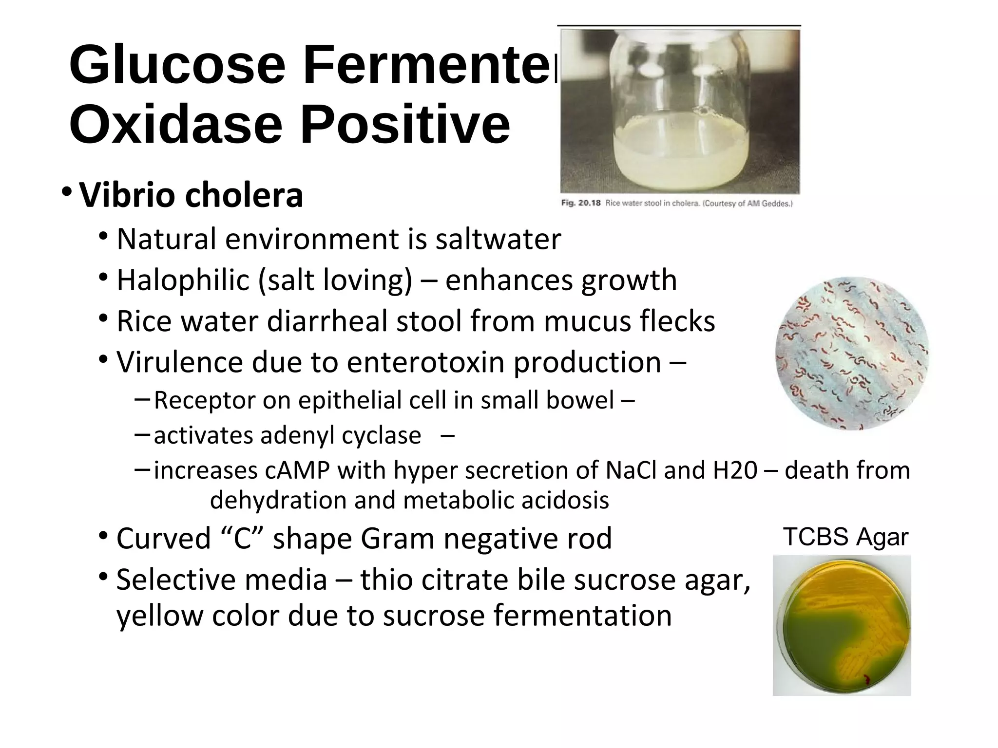 Glucose Fermenters
Oxidase Positive
•Vibrio cholera
• Natural environment is saltwater
• Halophilic (salt loving) – enhances growth
• Rice water diarrheal stool from mucus flecks
• Virulence due to enterotoxin production –
–Receptor on epithelial cell in small bowel –
–activates adenyl cyclase –
–increases cAMP with hyper secretion of NaCl and H20 – death from
dehydration and metabolic acidosis
• Curved “C” shape Gram negative rod
• Selective media – thio citrate bile sucrose agar,
yellow color due to sucrose fermentation
TCBS Agar
 