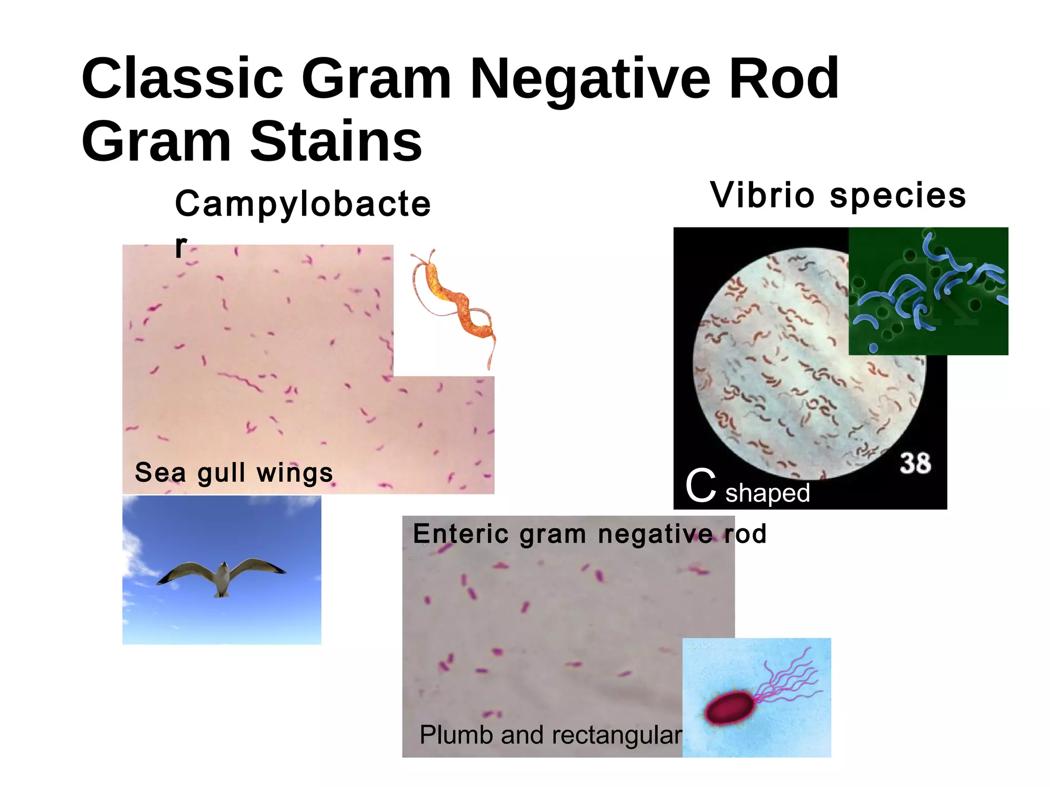 Classic Gram Negative Rod
Gram Stains
Campylobacte
r
Vibrio species
Enteric gram negative rod
Sea gull wings
C shaped
Plumb and rectangular
 