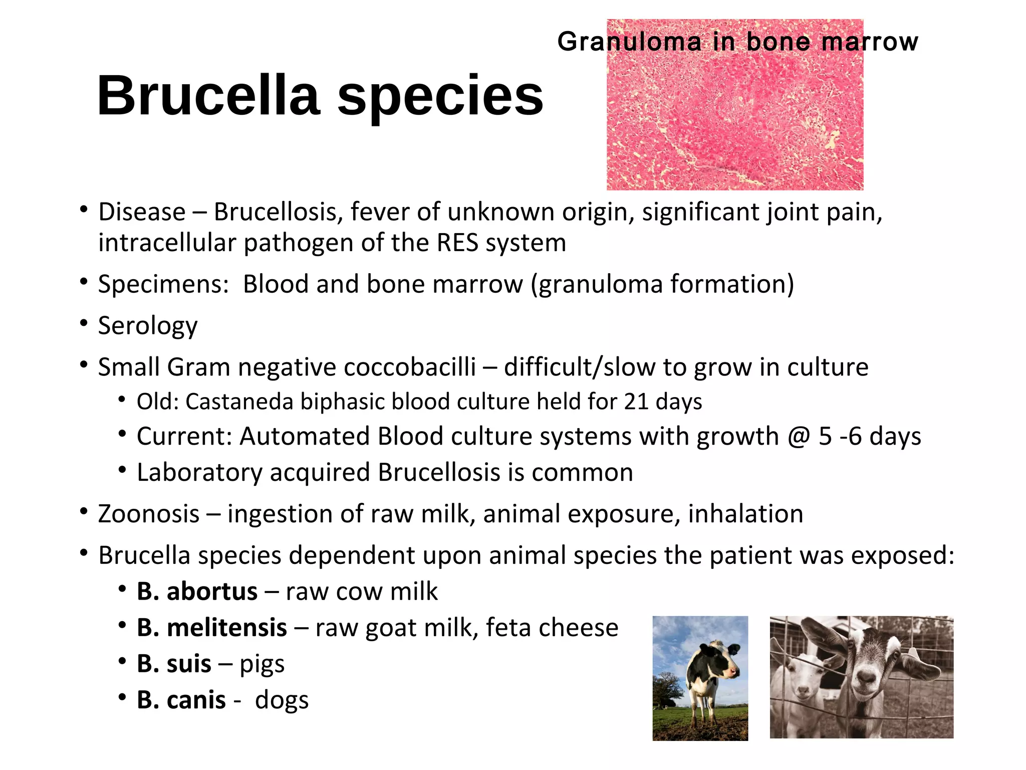 Brucella species
• Disease – Brucellosis, fever of unknown origin, significant joint pain,
intracellular pathogen of the RES system
• Specimens: Blood and bone marrow (granuloma formation)
• Serology
• Small Gram negative coccobacilli – difficult/slow to grow in culture
• Old: Castaneda biphasic blood culture held for 21 days
• Current: Automated Blood culture systems with growth @ 5 -6 days
• Laboratory acquired Brucellosis is common
• Zoonosis – ingestion of raw milk, animal exposure, inhalation
• Brucella species dependent upon animal species the patient was exposed:
• B. abortus – raw cow milk
• B. melitensis – raw goat milk, feta cheese
• B. suis – pigs
• B. canis - dogs
Granuloma in bone marrow
 