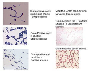 Gram positive cocci
in pairs and chains
Streptococcus
Gram Positive cocci
in clusters
Staphylococcus
Gram positive rod
most like a
Bacillus species
Gram negative bacilli, enteric
Gram negative rod – Fusiform
Shaped – Fusobacterium
species
Visit the Gram stain tutorial
for more Gram stains
 