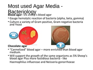 Most used Agar Media -
BacteriologyBlood agar- 5% sheep’s blood agar
• Gauge hemolytic reaction of bacteria (alpha, beta, ...