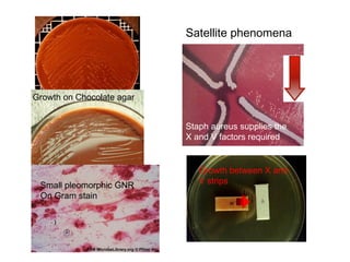 Satellite phenomena
Small pleomorphic GNR
On Gram stain
Growth on Chocolate agar
Growth between X and
V strips
Staph aureus supplies the
X and V factors required
 