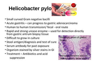 Helicobacter pylori
• Small curved Gram negative bacilli
• Acute gastritis – can progress to gastric adenocarcinoma
• Huma...