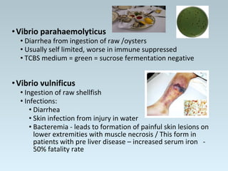•Vibrio parahaemolyticus
• Diarrhea from ingestion of raw /oysters
• Usually self limited, worse in immune suppressed
• TCBS medium = green = sucrose fermentation negative
•Vibrio vulnificus
• Ingestion of raw shellfish
• Infections:
• Diarrhea
• Skin infection from injury in water
• Bacteremia - leads to formation of painful skin lesions on
lower extremities with muscle necrosis / This form in
patients with pre liver disease – increased serum iron -
50% fatality rate
 