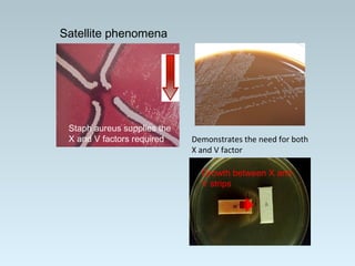 Satellite phenomena
Growth between X and
V strips
Staph aureus supplies the
X and V factors required Demonstrates the need for both
X and V factor
 